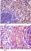 Anti-Interleukin 21 (IL-21) Antibody from rabbit, purified by affinity chromatography