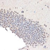 Anti-CoREST/RCOR1 antibody produced in rabbit