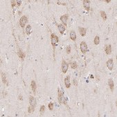 Anti-PREX1 antibody produced in rabbit Prestige Antibodies® Powered by Atlas Antibodies, affinity isolated antibody, buffered aqueous glycerol solution