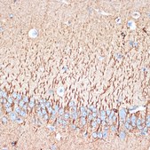 Anti-ACVR1B antibody produced in rabbit