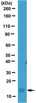 Anticuerpo anti-LC3 serum, from rabbit