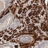 Anti-RNF19A antibody produced in rabbit Prestige Antibodies® Powered by Atlas Antibodies, affinity isolated antibody, buffered aqueous glycerol solution