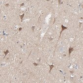 Anti-OPTN antibody produced in rabbit Ab2, Prestige Antibodies® Powered by Atlas Antibodies, affinity isolated antibody, buffered aqueous glycerol solution