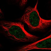 Anti-MED1 antibody produced in rabbit Prestige Antibodies® Powered by Atlas Antibodies, affinity isolated antibody