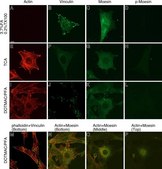 Monoclonal Anti-β-Actin antibody produced in mouse clone AC-15, ascites fluid