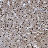 Anti-PPM1D antibody produced in rabbit Prestige Antibodies® Powered by Atlas Antibodies, affinity isolated antibody, buffered aqueous glycerol solution