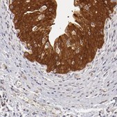Anti-SH2D4A antibody produced in rabbit Ab1, Prestige Antibodies® Powered by Atlas Antibodies, affinity isolated antibody, buffered aqueous glycerol solution