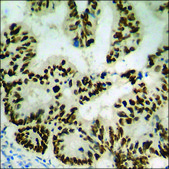 Anti-phospho-SSB (pSer366) antibody produced in rabbit affinity isolated antibody