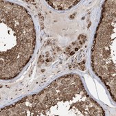 Anti-MAPKBP1 antibody produced in rabbit Prestige Antibodies® Powered by Atlas Antibodies, affinity isolated antibody, buffered aqueous glycerol solution