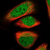 Anti-NAB2 antibody produced in rabbit Prestige Antibodies® Powered by Atlas Antibodies, affinity isolated antibody, buffered aqueous glycerol solution