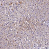 Anti-SLC13A5 antibody produced in rabbit Prestige Antibodies® Powered by Atlas Antibodies, affinity isolated antibody, buffered aqueous glycerol solution