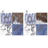 Anti-ANXA1 antibody produced in rabbit Prestige Antibodies® Powered by Atlas Antibodies, affinity isolated antibody, buffered aqueous glycerol solution