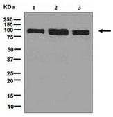 Anti-UBE3A, clone EPR7330, Rabbit Monoclonal Antibody clone EPR7330, from rabbit
