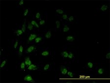 Monoclonal Anti-TAF7 antibody produced in mouse clone 2C5, purified immunoglobulin, buffered aqueous solution