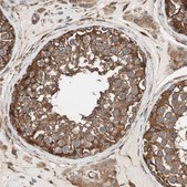Anti-GPSM2 antibody produced in rabbit affinity isolated antibody, buffered aqueous glycerol solution