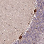 Anti-RPS3A antibody produced in rabbit Prestige Antibodies® Powered by Atlas Antibodies, affinity isolated antibody, buffered aqueous glycerol solution
