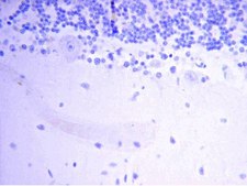Anti-Neurofilament M (145 kDa) Antibody, CT serum, Chemicon®