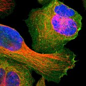Anti-SNAP23 antibody produced in rabbit Prestige Antibodies® Powered by Atlas Antibodies, affinity isolated antibody, buffered aqueous glycerol solution