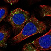 Anti-RBSN antibody produced in rabbit Prestige Antibodies® Powered by Atlas Antibodies, affinity isolated antibody, buffered aqueous glycerol solution