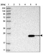 Anti-ABHD14B antibody produced in rabbit Prestige Antibodies® Powered by Atlas Antibodies, affinity isolated antibody, buffered aqueous glycerol solution