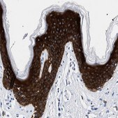 Anti-TRIM29 antibody produced in rabbit Prestige Antibodies® Powered by Atlas Antibodies, affinity isolated antibody, buffered aqueous glycerol solution