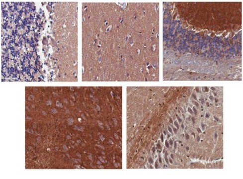 Anti-Ankyrin-B Antibody, clone N105/13 clone N105/13, from mouse