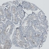 Anti-RSPH9 antibody produced in rabbit Prestige Antibodies® Powered by Atlas Antibodies, affinity isolated antibody, buffered aqueous glycerol solution