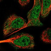 Anti-USP24 antibody produced in rabbit Prestige Antibodies® Powered by Atlas Antibodies, affinity isolated antibody, buffered aqueous glycerol solution, ab2