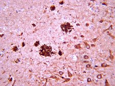 Anti-Amyloid β Antibody, clone W0-2 clone WO2, from mouse
