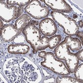 Anti-SLC4A4 antibody produced in rabbit Prestige Antibodies® Powered by Atlas Antibodies, affinity isolated antibody, buffered aqueous glycerol solution
