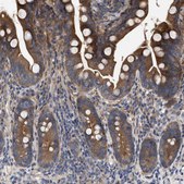 Anti-CDKN2C antibody produced in rabbit Prestige Antibodies® Powered by Atlas Antibodies, affinity isolated antibody, buffered aqueous glycerol solution
