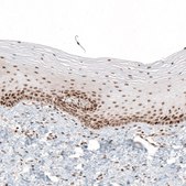 Anti-HLTF antibody produced in rabbit Prestige Antibodies® Powered by Atlas Antibodies, affinity isolated antibody, buffered aqueous glycerol solution