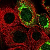 Anti-MRPS7 antibody produced in rabbit Prestige Antibodies® Powered by Atlas Antibodies, affinity isolated antibody, buffered aqueous glycerol solution, Ab1