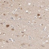 Anti-ARHGEF7 antibody produced in rabbit Prestige Antibodies® Powered by Atlas Antibodies, affinity isolated antibody, buffered aqueous glycerol solution