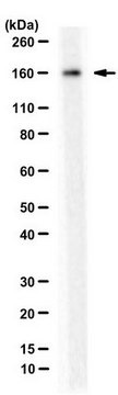 Anti-FANCI Antibody, (G4270) from rabbit, purified by affinity chromatography