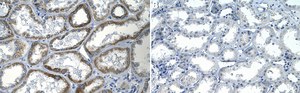 Anti-TRPV1 Antibody, clone 1N19 ZooMAb® Rabbit Monoclonal recombinant, expressed in HEK 293 cells