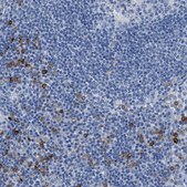 Anti-CLEC10A antibody produced in rabbit Prestige Antibodies® Powered by Atlas Antibodies, affinity isolated antibody, buffered aqueous glycerol solution, Ab1