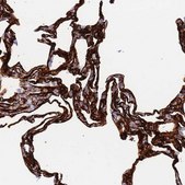 Anti-CAV2 antibody produced in rabbit Prestige Antibodies® Powered by Atlas Antibodies, affinity isolated antibody, buffered aqueous glycerol solution