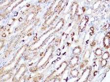 Anti-ACADM antibody produced in rabbit