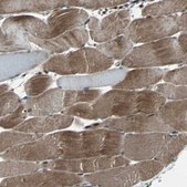 Anti-RAB7A antibody produced in rabbit Prestige Antibodies® Powered by Atlas Antibodies, affinity isolated antibody, buffered aqueous glycerol solution