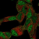 Anti-BTF3L4 antibody produced in rabbit Prestige Antibodies® Powered by Atlas Antibodies, affinity isolated antibody, buffered aqueous glycerol solution