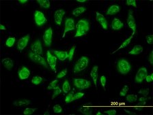 Monoclonal Anti-NCOA4, (C-terminal) antibody produced in mouse clone 1F11, purified immunoglobulin, buffered aqueous solution