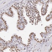 Anti-HNRNPH2 antibody produced in rabbit Ab1, Prestige Antibodies® Powered by Atlas Antibodies, affinity isolated antibody, buffered aqueous glycerol solution