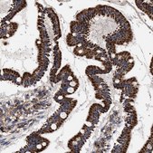 Anti-COG5 antibody produced in rabbit Prestige Antibodies® Powered by Atlas Antibodies, affinity isolated antibody, buffered aqueous glycerol solution