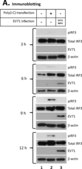 Anti-Enterovirus 71 Antibody, cross-reacts with Coxsackie A16, clone 422-8D-4C-4D ascites fluid, clone 422-8D-4C-4D, Chemicon®