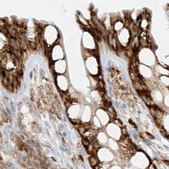 Anti-LRRC59 antibody produced in rabbit Prestige Antibodies® Powered by Atlas Antibodies, affinity isolated antibody, buffered aqueous glycerol solution