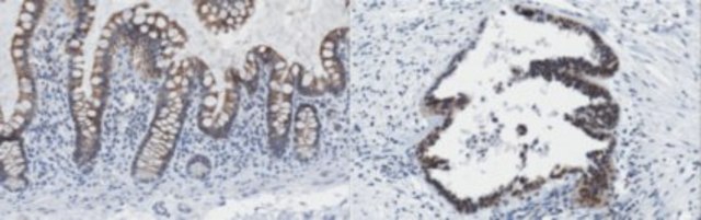 Anti-ING3 Antibody, clone 2A2 clone 2A2, from mouse