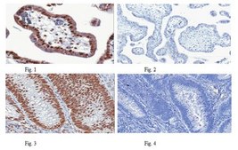 Anti-Replication Protein A Antibody, clone RPA34-19 clone RPA34-19, from mouse