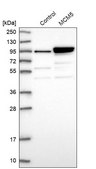 Anti-MCM5 antibody produced in rabbit Prestige Antibodies® Powered by Atlas Antibodies, affinity isolated antibody, buffered aqueous glycerol solution