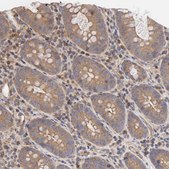 Anti-STRN3 antibody produced in rabbit Ab2, Prestige Antibodies® Powered by Atlas Antibodies, affinity isolated antibody, buffered aqueous glycerol solution
